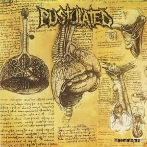 Haematoma