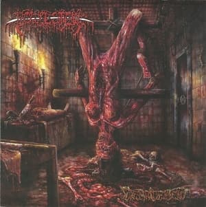 Debridement