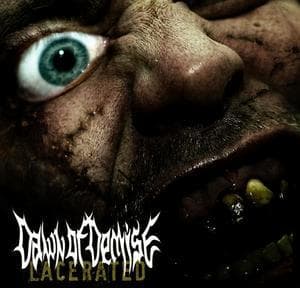 Lacerated