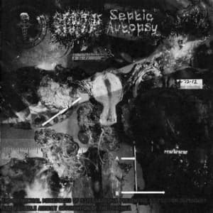 As Position Dependent And Variable Airway Obstruction Of The Trachea