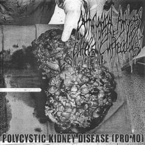 Polycystic Kidney Desease (promo)