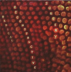 Scotty Hard's Radical Reconstructive Surgery