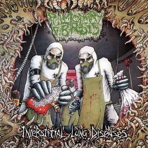 Interstitial Lung Diseases