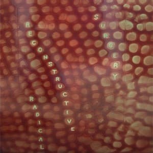 Scotty Hard`s Radical Reconstructive Surgery