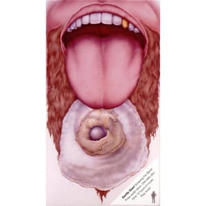 Scraping The Barrel (3CD)