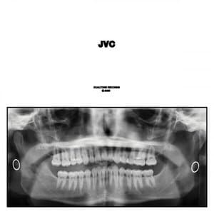 JVC
