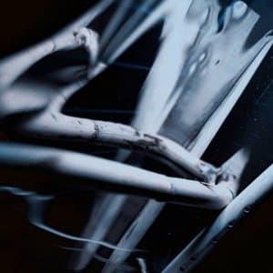 Aboyer au mauvais arbre