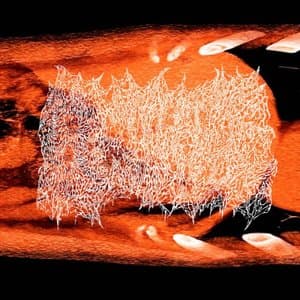 Resonate And Amplify