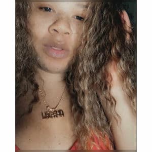 Freckle Face, Freckles on My Chest