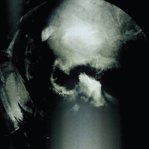 Den Forfoljdes Gryning