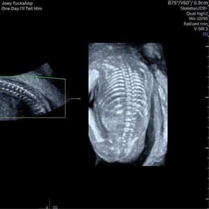 one day ill tell him