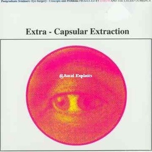Extra-Сapsular Extraction [EP]