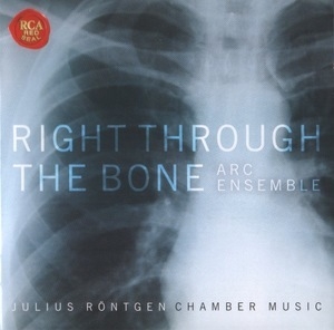 Roentgen - Right Through The Bone