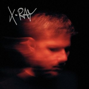 X-Ray