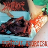 Excrement  &  Hipermenorrea - Surgical Exorcism / Auriculoventriculostomia Cefalorraquidea Subaracnoidea Basilar Cerebral '2005