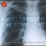 Arc Ensemble - Roentgen - Right Through The Bone '2007