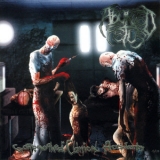 Aborted Fetus - Goresoaked Clinical Accidents '2008